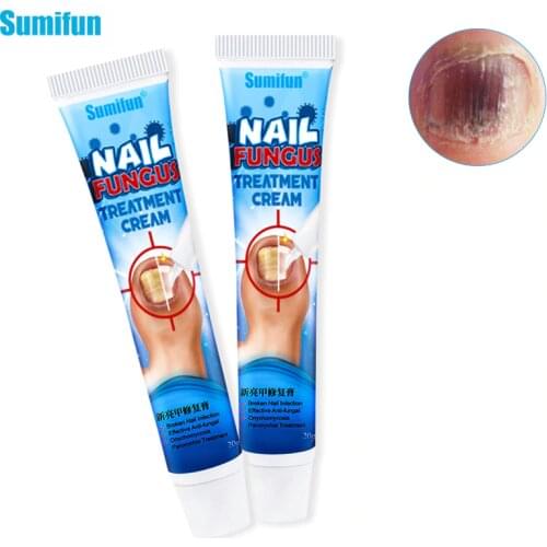 Sumifun 1pcs Effective Nail Cream Fungus Removal Nail Treatment Psoriasis Foot Nail Fungus Care Protector Against Herb Repair