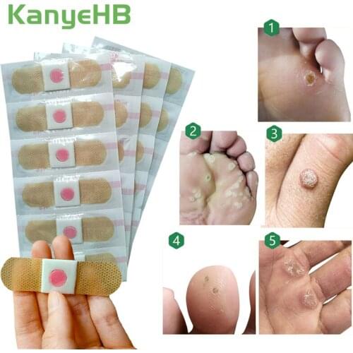 24pcs Foot Care Sticker Medical Patch Corn Removal Pads Warts Thorn Curative Patches Calluses Remove Callosity Detox Pad A293