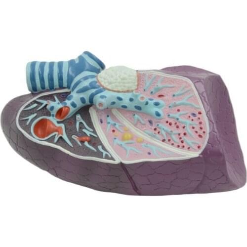 Diseased Human Lung Structure Respiratory System Model for Anatomical Study Display Teach Anatomy Medical Supply and Equipment