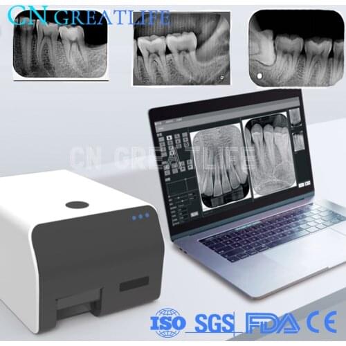 HD Fast Imaging Wireless Digital Shooting Image Plate Scanner Eq600vrn Imaging Plate PSP Scanner Dental Scanner
