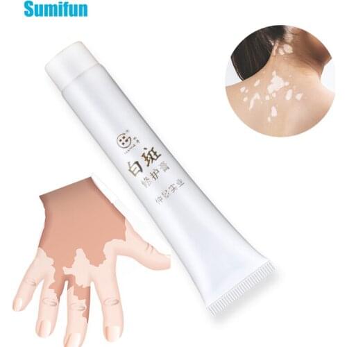 Sumifun Vitiligo Repair Ointment Chinese White Spot Disease Cream Antibacterial Leukoplakia Disease TreatmentP1159