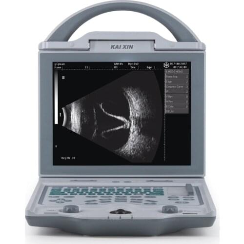 Best laptop portable handheld price of Ophthalmological A/B mode scanner ultrasound machine