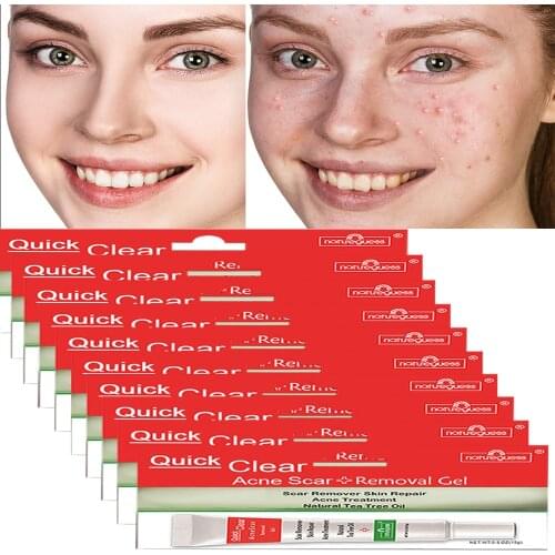 Natureguess Skin Care Products