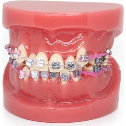 New Dental Orthodontic Treatment Malocclusion Model With Ceramic Brackets Chain Wire For Medical Science Teaching 2018 New