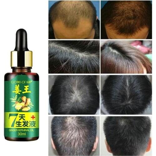 7 Day Ginger Germinal Serum Essence Oil Loss Treatement Growth Hair 30ML Healthy Hair Growth Essence Oil