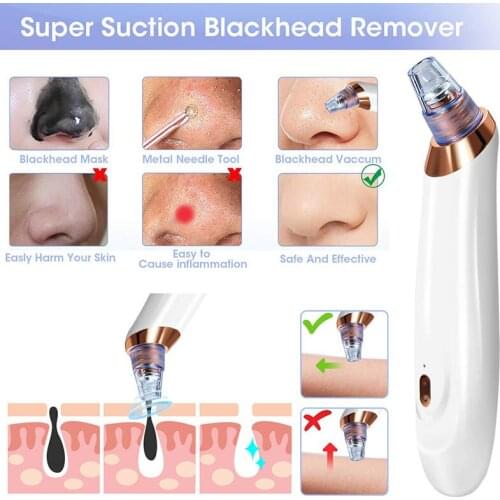 Blackhead Skin Care Face Deep Pore Acne Pimple Removal Vacuum Suction Facial Diamond Beauty Tool Dropshipping Discounted Price