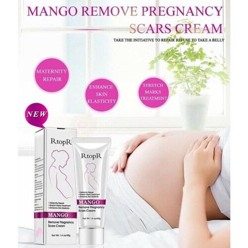 Mango Remove Pregnancy Scars Acne Cream Stretch Marks Treatment Maternity Repair Anti-Aging Anti-Winkles Firming Repair Creams