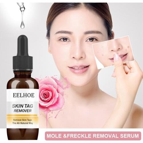 Eelhoe Essential Oil For Whitening Moles And Spots TSLM2