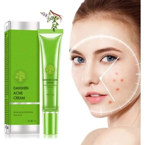 Effective Acne Removal Cream Acne Treatment Fade Acne Spots Oil Control Shrink Pores Whitening Moisturizing Acne Cream Skin Care