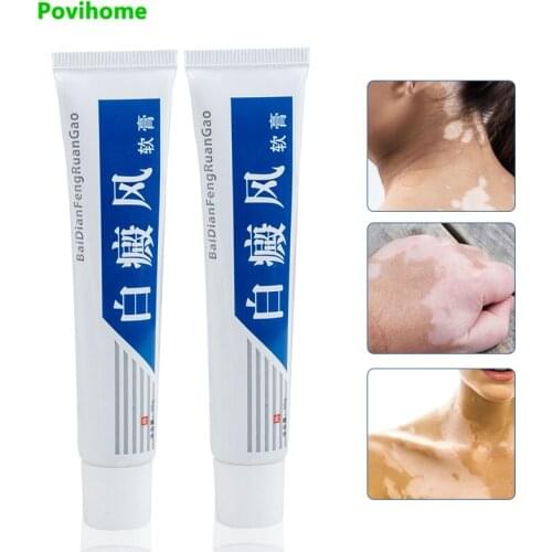 30g Vitiligo Leukoplakia Treament Cream White Spot Repair Cream Localized Vitiligo Chinese Medical Pigment Melanin Skin Care