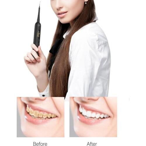 Genkent Oral Irrigator