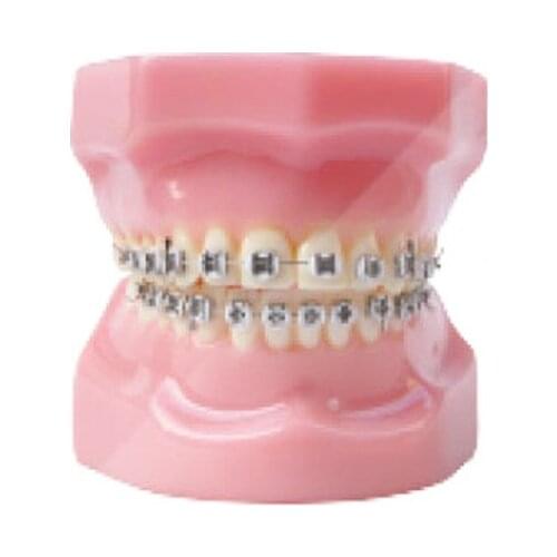 1pc Orthodontic teeth models dental education teeth model jaws with metal bracket Dental Models Teeth and Jaw Models