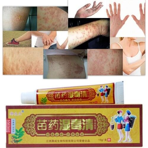 Natural Chinese Medicine Herbal Anti Bacteria Cream Psoriasis Ointment Eczema Cream psoriasis Treatment For Skin Problems