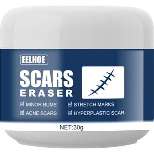 Pregnancy Body Scar Removal Cream Spots Healing Burns Scald Maternity Repair Stretch Marks Acne Treatment Pigmentation Ointment