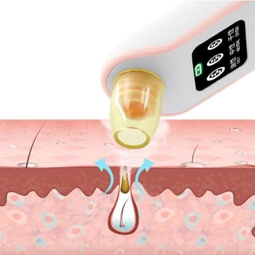 Extractor of Blackhead And Pimple Nipple Sucker Clove Acne Black Dots Apparatus From Blackdot Vacuum Cleaner for Face Black Head