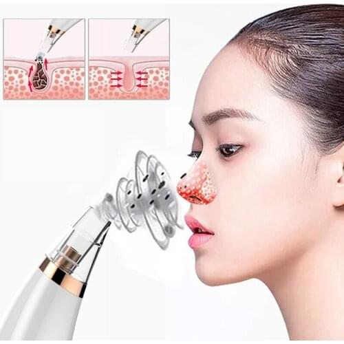 Electric Blackhead Suction Instrument Beauty To Remove Acne Pores Clean Blackheads Suction Facial Clean Skin Tool