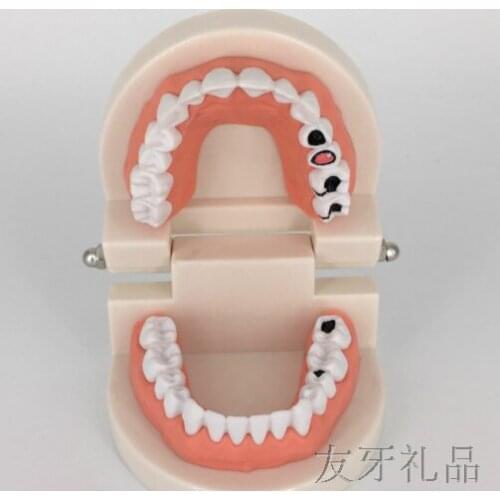 Dental caries teeth brushing model childrens early education dental model