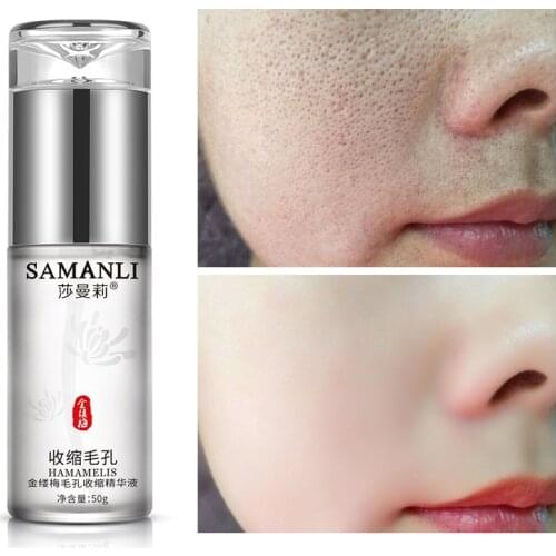 Witch Hazel Shrink Pore Essence Skin Care Serum Moisturizing Hydrating Anti -aging Wrinkles Acne Treatment Face Care 50 ml