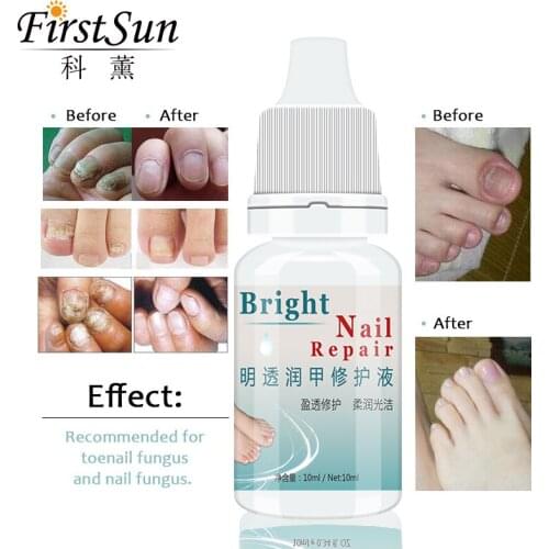 3PCS Firstsun Nail Cuticle Oil Nutrition Nail Oil for Nails Fungus Removal Fungal Nail Treatment Feet Care Bright Whitening Toe
