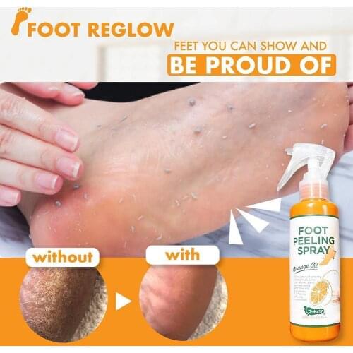 Foot Exfoliating Spray Can Remove Dead Skin On Feet, Elbows And Knees, Remove Calluses And Crusty Foot Care