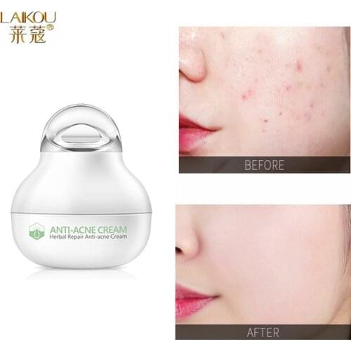 Acne Treatment Cream Skin Repair Moisturizing Acne Scar Removal Anti Acne Oil Control Shrink Pores Whitening Korean Cosmetics 8g