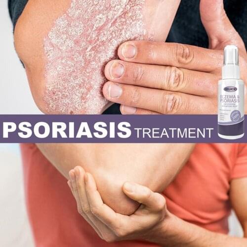 Anti Fungal Spray Dermatitis Psoriasis Skin Care Salicylic Allergies Athlete Solution Acid Relieve Skin Foot Spray E9L7