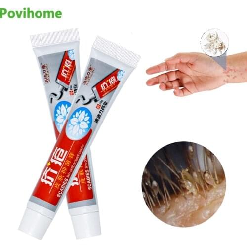 1Pcs 20g Head Lice Removal Cream Antibacterial Ointment Psoriasis Antipruritic Treatment Skin Care Herbal Medical Plaster