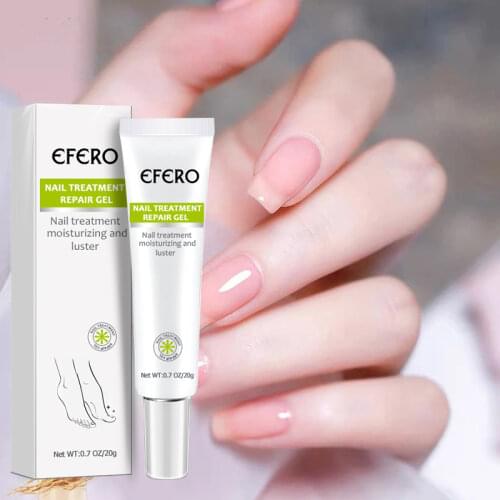 Fungal Nail Repair Essence Serum Nail Care Treatment Foot Nail Fungus Removal Gel Anti Infection Paronychia Onychomycosis