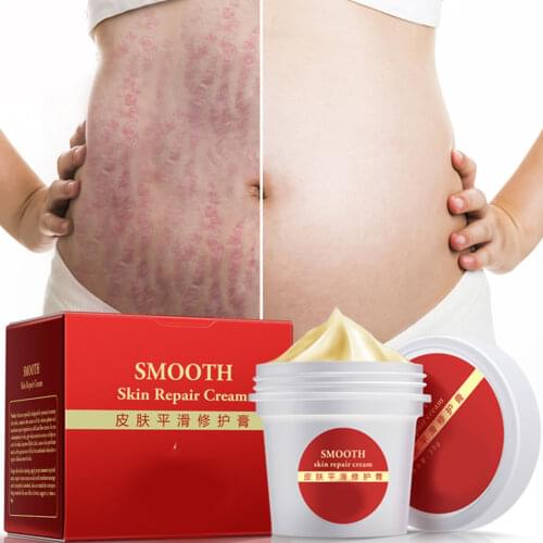 Smooth Skin Cream for Stretch Marks Scar Removal Postpartum Skin Repair Body Cream SK88