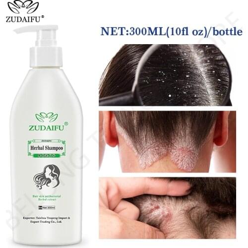 Zudaifu Hair Psoriasis Seborrheic Skin Care Treatment Dermatitis Eczema Compound Herbal Shampoo Repair Scalp, Remove Dandruff