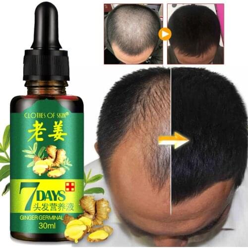 New Arrival 7 Days Hair Essential Oil Hair Care Oil Hairdressing Hair Mask Ginger King Essential Oil Dry Damaged Hair Nutrition