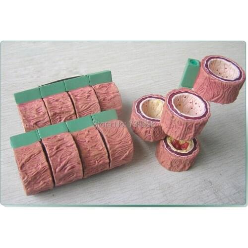 Atherosclerosis Model,Thromboembolism Disease model,Artery Model
