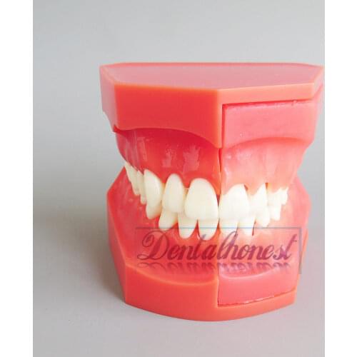 Dental Model #4006 01 - Teeth Eruption Development Model 2017 New Model