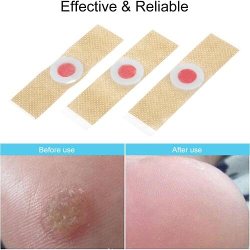 12/18/24 PCS Corn Remover Wart Remover Foot Corn Remover Pads Corn Callus Remover Cushions Corn Plaster Corn Foot Care