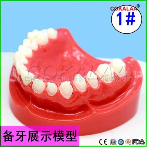 Good quality Preparation model dental implant model dentures teeth model for dentists learning