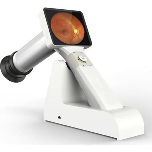 Digital fundus camera HFC-100 ophthalmic instrument