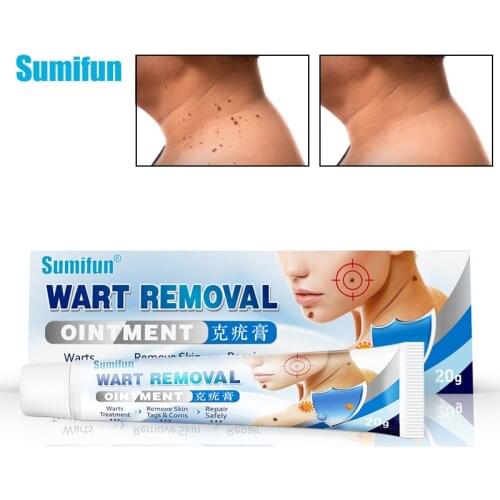 Sumifun 20g Skin Tag Remover Wart Cream Micro Removal Ointment Treat Acne Herpes Mole Wart Face Care Herbal Ointment P1210
