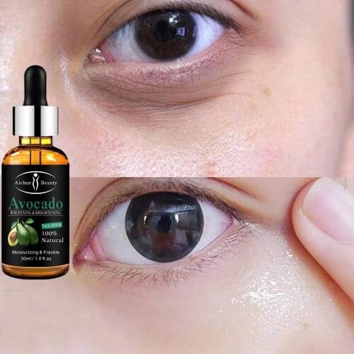 Instant Remove Eye Bags Avocado Serum Anti Aging puffiness Remove Dark Circles Whitening Skin Care Eye Firming Original Fluid