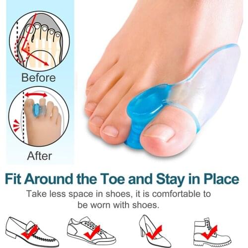 1Pair Toes Separator Orthotics Feet Bone Thumb Adjuster Correction Hallux Valgus Bunion Corrector Pedicure Silicone Straightener