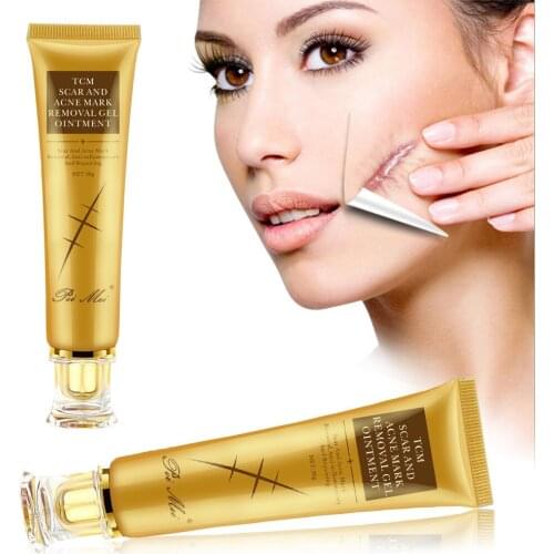 30g Acne Scar Removal Cream Pimples Stretch Marks Face Gel Remove Acne Smoothing Whitening Moisturizing Body Skin Care