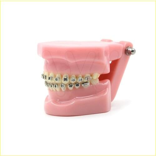 Dental Orthodontics Typodont Teeth Model Metal Brace bracket Typodont with Arch Wire