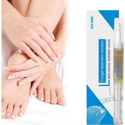 3ml Fungal Nail Treatment Pen Onychomycosis Paronychia Anti Fungal Nail Infection Chinese Herbal Care Medicinal Liquid 1pc