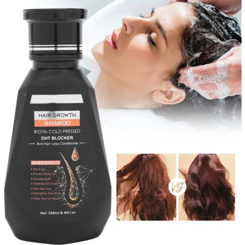 Shampoo Bar 250ML Ginger Shampoo Anti-Hair Loss Deep Cleaning Hair Thickening Herbal Shampoo Oil Control