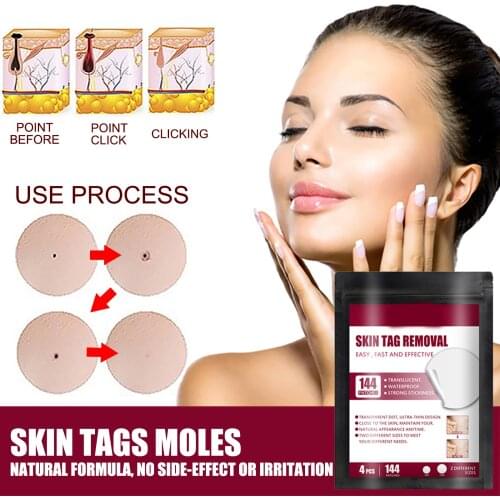 Instant Spot Removal Gel Skin Tag Removal Patches Wart Removal Body Warts Treatment Foot Care Cream Skin Tag Remover A7