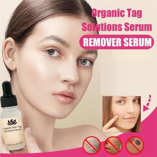 Oragnic Tag Solutions Serum Remove Serum Mighty Tag & Spots Remover Serum Painless Mole Tag Cream Skin Tag Face Dark Removal