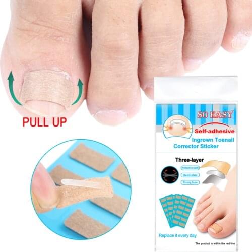 Baileton Foot Care Tools