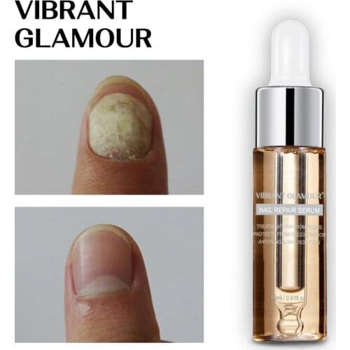 VIBRANT GLAMOUR Nail Repair SerumFungus Onychomycosis Nail Treatment Essence Removal Anti Fungus Nail Toe Nourishing Nail Care