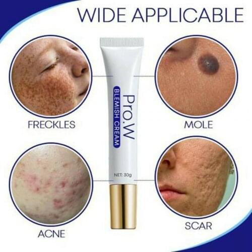 2021 PRO.W Acne Cream Anti-acne Cream Blemish Cream Water-oil Balance Acne Cream Moisturizing Skin Cream Blemish Cream TSLM2