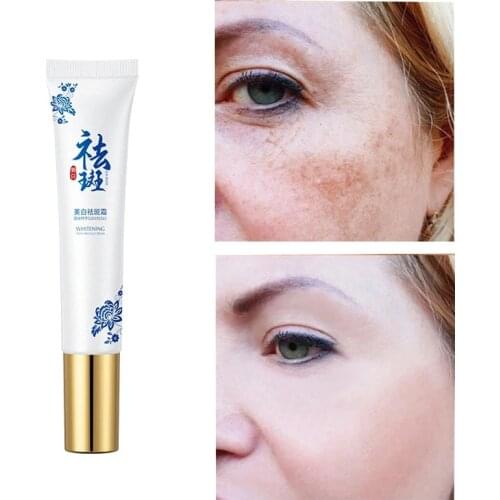 Whitening Freckle Cream Remove Melasma Acne Spot Pigment Melanin Dark Spots Pigmentation Moisturizing Gel Skin Care