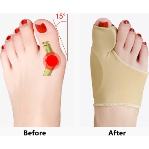 1 Pair Toe Separator Ultrathin Bunion Orthotics Hallux Valgus Forefoot Pad Big Toe Overlapped Toe Divider Pain Relief Foot Care
